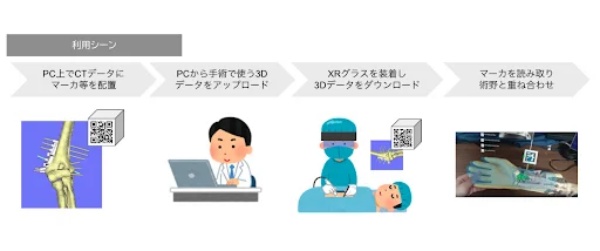 ARで骨切り断面をリアルタイム表示