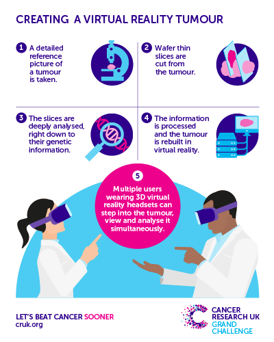VRをがん治療に活用！患者の腫瘍の状態をより正確に把握